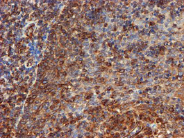 SCFD1 / SLY1 Antibody - IHC of paraffin-embedded Human tonsil using anti-SCFD1 mouse monoclonal antibody.