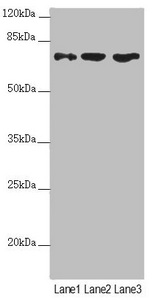 SCFD1 / SLY1 Antibody - Western blot All Lanes: SCFD1 antibody at 4.48 ug/ml Lane 1: Mouse liver tissue Lane 2: Hela whole cell lysate Lane 3: A549 whole cell lysate Secondary Goat polyclonal to rabbit IgG at 1/10000 dilution Predicted band size: 73,63,66 kDa Observed band size: 72 kDa