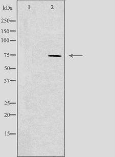 SCFD1 / SLY1 Antibody - Western blot analysis of extracts of A549 cells using SCFD1 antibody. The lane on the left is treated with the antigen-specific peptide.