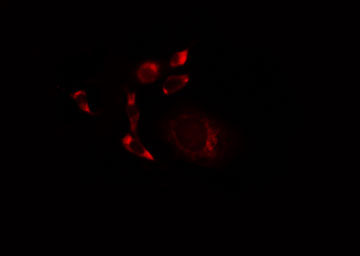 SCFD1 / SLY1 Antibody - Staining A549 cells by IF/ICC. The samples were fixed with PFA and permeabilized in 0.1% Triton X-100, then blocked in 10% serum for 45 min at 25°C. The primary antibody was diluted at 1:200 and incubated with the sample for 1 hour at 37°C. An Alexa Fluor 594 conjugated goat anti-rabbit IgG (H+L) antibody, diluted at 1/600, was used as secondary antibody.