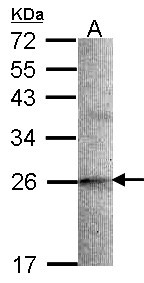 SCG10 / STMN2 Antibody - Sample (30 ug of whole cell lysate). A: A549 12% SDS PAGE. SCG10 / STMN2 antibody diluted at 1:1000.