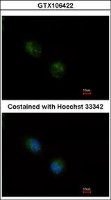 SCG10 / STMN2 Antibody - Immunofluorescence of methanol-fixed A549 using STMN2 antibody at 1:500 dilution.