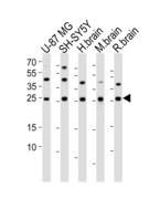 SCG10 / STMN2 Antibody - Western blot of lysates from U-87 MG, SH-SY5Y cell line, human brain, mouse brain, rat brain tissue lysate (from left to right) with STMN2 Antibody. Antibody was diluted at 1:1000 at each lane. A goat anti-rabbit IgG H&L (HRP) at 1:10000 dilution was used as the secondary antibody. Lysates at 35 ug per lane.