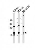 SCG10 / STMN2 Antibody - All lanes : Anti-STMN2 Antibody at 1:1000 dilution Lane 1: human brain lysates Lane 2: mouse brain lysates Lane 3: SH-SY5Y whole cell lysates Lysates/proteins at 20 ug per lane. Secondary Goat Anti-Rabbit IgG, (H+L), Peroxidase conjugated at 1/10000 dilution Predicted band size : 21 kDa Blocking/Dilution buffer: 5% NFDM/TBST.
