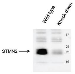 SCG10 / STMN2 Antibody - STMN2 Antibody - Western blot of endogenous STMN2 in mouse dorsal root ganglia (DRG) neurons. A partial siRNA knockdown was used in the second lane. Antibody was used at a dilution of 1:1000.