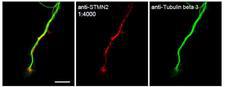 SCG10 / STMN2 Antibody - STMN2 Antibody - Staining of STMN2 in primary mouse dorsal root ganglia neurons. Shows the expected staining of endogenous STMN2 in axons and growth cones. Tubulin is a marker of axons. Antibody was used at a dilution of 1:4000.