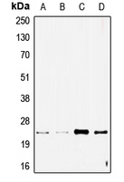 SCG10 / STMN2 Antibody - Western blot analysis of STMN2 expression in SHSY5Y (A); NIH3T3 (B); A549 (C); rat brain (D) whole cell lysates.