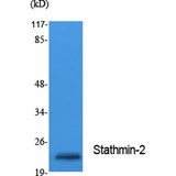 SCG10 / STMN2 Antibody - Western blot of Stathmin-2 antibody