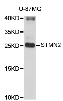 SCG10 / STMN2 Antibody - Western blot analysis of extracts of U-87MG cells.
