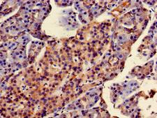 SCG10 / STMN2 Antibody - Immunohistochemistry of paraffin-embedded human pancreatic tissue using STMN2 Antibody at dilution of 1:100