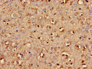 SCG10 / STMN2 Antibody - Immunohistochemistry of paraffin-embedded human brain tissue using STMN2 Antibody at dilution of 1:100