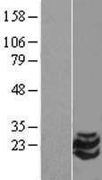 SCG10 / STMN2 Protein - Western validation with an anti-DDK antibody * L: Control HEK293 lysate R: Over-expression lysate