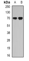 SCG2 / Secretogranin II Antibody - Western blot analysis of Secretogranin-2 expression in SW620 (A); Jurkat (B) whole cell lysates.