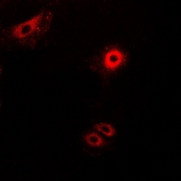 SCG2 / Secretogranin II Antibody - Immunofluorescent analysis of Secretogranin-2 staining in MCF7 cells. Formalin-fixed cells were permeabilized with 0.1% Triton X-100 in TBS for 5-10 minutes and blocked with 3% BSA-PBS for 30 minutes at room temperature. Cells were probed with the primary antibody in 3% BSA-PBS and incubated overnight at 4 deg C in a humidified chamber. Cells were washed with PBST and incubated with a DyLight 594-conjugated secondary antibody (red) in PBS at room temperature in the dark.