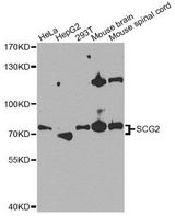 SCG2 / Secretogranin II Antibody - Western blot analysis of extracts of various cell lines, using SCG2 antibody at 1:1000 dilution. The secondary antibody used was an HRP Goat Anti-Rabbit IgG (H+L) at 1:10000 dilution. Lysates were loaded 25ug per lane and 3% nonfat dry milk in TBST was used for blocking. An ECL Kit was used for detection and the exposure time was 90s.