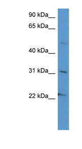 SCG3 / Secretogranin 3 Antibody - SCG3 / Secretogranin 3 antibody Western blot of HepG2 cell lysate.  This image was taken for the unconjugated form of this product. Other forms have not been tested.