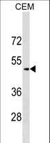 SCG3 / Secretogranin 3 Antibody - SCG3 Antibody western blot of CEM cell line lysates (35 ug/lane). The SCG3 antibody detected the SCG3 protein (arrow).