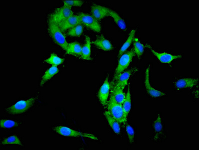 SCG3 / Secretogranin 3 Antibody - Immunofluorescent analysis of Hela cells at a dilution of 1:100 and Alexa Fluor 488-congugated AffiniPure Goat Anti-Rabbit IgG(H+L)