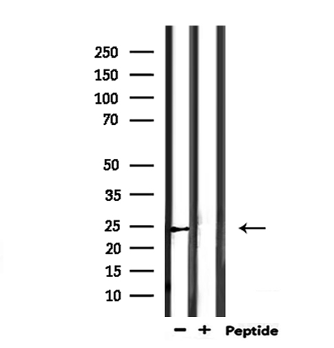 SCG5 / 7B2 Antibody - Western blot analysis of extracts of mouse muscle using SCG5 antibody.