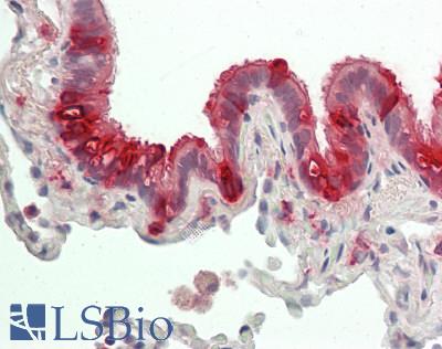 SCGB1A1 / Uteroglobin Antibody - Human Lung, Repiratory Epithelium: Formalin-Fixed, Paraffin-Embedded (FFPE).  This image was taken for the unconjugated form of this product. Other forms have not been tested.