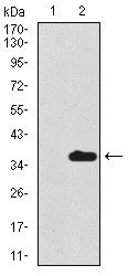 SCGB1A1 / Uteroglobin Antibody - Uteroglobin Antibody in Western Blot (WB)
