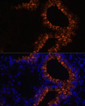 SCGB1A1 / Uteroglobin Antibody - Immunofluorescence analysis of Mouse lung cells using SCGB1A1 Polyclonal Antibody at dilution of 1:100.Blue: DAPI for nuclear staining.
