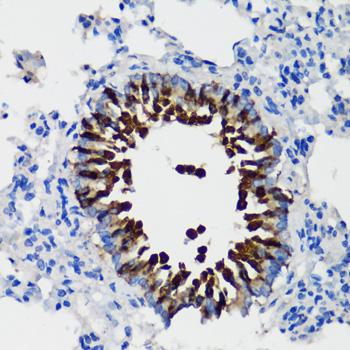 SCGB1A1 / Uteroglobin Antibody - Immunohistochemistry of paraffin-embedded Rat lung using SCGB1A1 Polyclonal Antibody at dilution of 1:100 (40x lens).