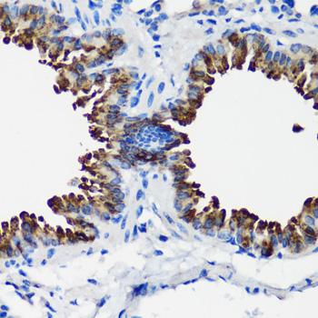 SCGB1A1 / Uteroglobin Antibody - Immunohistochemistry of paraffin-embedded Mouse lung using SCGB1A1 Polyclonal Antibody at dilution of 1:100 (40x lens).