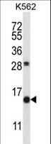 SCGB1D2 / Lipophilin B Antibody - SCGB1D2 Antibody western blot of K562 cell line lysates (35 ug/lane). The SCGB1D2 antibody detected the SCGB1D2 protein (arrow).