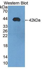 SCGB1D2 / Lipophilin B Antibody - Western blot of SCGB1D2 / Lipophilin B antibody.