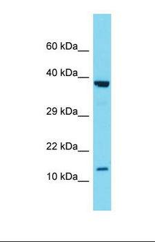 SCGB2A1 / Mammaglobin B Antibody - Western blot of Human Fetal Liver. SCGB2A1 antibody dilution 1.0 ug/ml.  This image was taken for the unconjugated form of this product. Other forms have not been tested.
