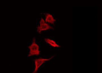 SCGB2A1 / Mammaglobin B Antibody - Staining HepG2 cells by IF/ICC. The samples were fixed with PFA and permeabilized in 0.1% Triton X-100, then blocked in 10% serum for 45 min at 25°C. The primary antibody was diluted at 1:200 and incubated with the sample for 1 hour at 37°C. An Alexa Fluor 594 conjugated goat anti-rabbit IgG (H+L) Ab, diluted at 1/600, was used as the secondary antibody.