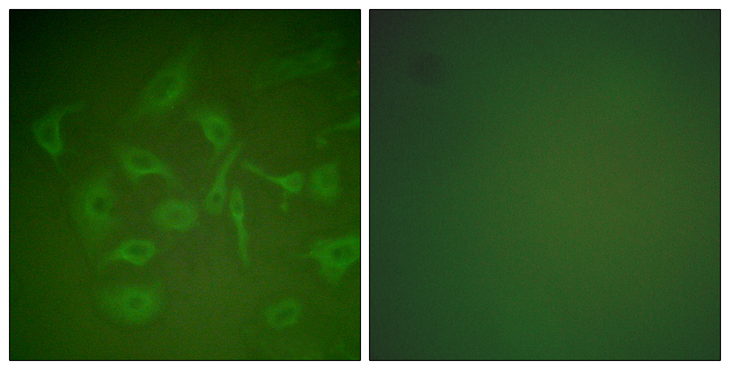 SCGB2A2 / Mammaglobin A Antibody - Immunofluorescence analysis of HepG2 cells, using Mammaglobin Antibody. The picture on the right is blocked with the synthesized peptide.