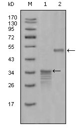 SCGB2A2 / Mammaglobin A Antibody - Western blot using Mammaglobin-1 mouse monoclonal antibody against full-length GST- Mammaglobin-1 (1) and full-length MBP- Mammaglobin-1 (aa1-193) recombinant protein (2).