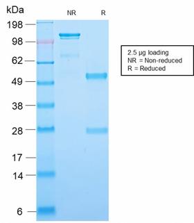 SCGB2A2 / Mammaglobin A Antibody - SDS-PAGE Analysis Purified Recombinant Rabbit Monoclonal Ab (MGB1/2123R) to Mammaglobin. Confirmation of Purity and Integrity of Antibody.