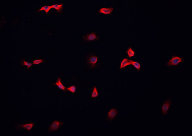 SCGB2A2 / Mammaglobin A Antibody - Staining HeLa cells by IF/ICC. The samples were fixed with PFA and permeabilized in 0.1% Triton X-100, then blocked in 10% serum for 45 min at 25°C. The primary antibody was diluted at 1:200 and incubated with the sample for 1 hour at 37°C. An Alexa Fluor 594 conjugated goat anti-rabbit IgG (H+L) antibody, diluted at 1/600, was used as secondary antibody.