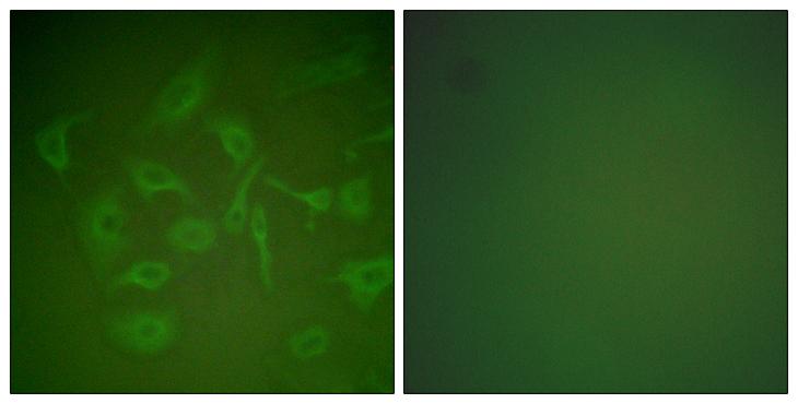 SCGB2A2 / Mammaglobin A Antibody - Peptide - + Immunofluorescence analysis of HepG2 cells, using Mammaglobin Antibody.