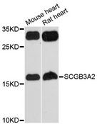 SCGB3A2 Antibody - Western blot analysis of extracts of various cell lines, using SCGB3A2 antibody at 1:3000 dilution. The secondary antibody used was an HRP Goat Anti-Rabbit IgG (H+L) at 1:10000 dilution. Lysates were loaded 25ug per lane and 3% nonfat dry milk in TBST was used for blocking. An ECL Kit was used for detection and the exposure time was 90s.