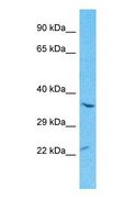 SCGF Antibody - Western blot of CLC11 Antibody with human Ovary Tumor lysate.  This image was taken for the unconjugated form of this product. Other forms have not been tested.