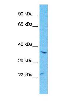 SCGF Antibody - Western blot of CLC11 Antibody with human Ovary Tumor lysate.  This image was taken for the unconjugated form of this product. Other forms have not been tested.