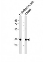 SCGF Antibody - All lanes : Anti-CLEC11A Antibody at 1:2000 dilution Lane 1: human skeletal muscle lysates Lane 2: human heart lysates Lysates/proteins at 20 ug per lane. Secondary Goat Anti-Rabbit IgG, (H+L), Peroxidase conjugated at 1/10000 dilution Predicted band size : 36 kDa Blocking/Dilution buffer: 5% NFDM/TBST.