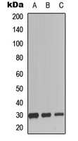 SCGF Antibody - Western blot analysis of SCGF expression in HEK293T (A); mouse spleen (B); rat spleen (C) whole cell lysates.