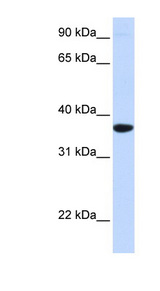 SCGN / Secretagogin Antibody - SCGN antibody Western blot of Fetal Muscle lysate. This image was taken for the unconjugated form of this product. Other forms have not been tested.
