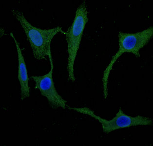 SCGN / Secretagogin Antibody - Immunofluorescent analysis of Hela cells using SCGN Antibody at dilution of 1:100 and Alexa Fluor 488-congugated AffiniPure Goat Anti-Rabbit IgG(H+L)