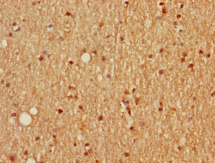 SCGN / Secretagogin Antibody - Immunohistochemistry of paraffin-embedded human brain tissue using SCGN Antibody at dilution of 1:100