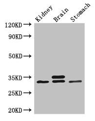 SCGN / Secretagogin Antibody - Western Blot Positive WB detected in: Mouse kidney tissue, Mouse brain tissue, Mouse stomach tissue All lanes: SCGN antibody at 3µg/ml Secondary Goat polyclonal to rabbit IgG at 1/50000 dilution Predicted band size: 33 kDa Observed band size: 33, 34 kDa