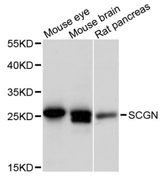 SCGN / Secretagogin Antibody - Western blot analysis of extracts of various cell lines, using SCGN antibody at 1:3000 dilution. The secondary antibody used was an HRP Goat Anti-Rabbit IgG (H+L) at 1:10000 dilution. Lysates were loaded 25ug per lane and 3% nonfat dry milk in TBST was used for blocking. An ECL Kit was used for detection and the exposure time was 90s.
