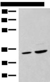 SCGN / Secretagogin Antibody - Western blot analysis of Hela cell and Human fetal liver tissue lysates  using SCGN Polyclonal Antibody at dilution of 1:600