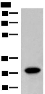 SCGN / Secretagogin Antibody - Western blot analysis of Human fetal brain tissue lysate  using SCGN Polyclonal Antibody at dilution of 1:600