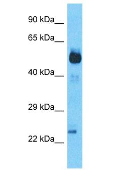 SCHIP1 Antibody - SCHIP1 antibody Western Blot of Lung Tumor. Antibody dilution: 1 ug/ml.  This image was taken for the unconjugated form of this product. Other forms have not been tested.